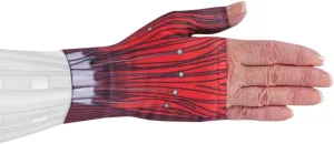 Cyborg Medical Graduated Compression Gauntlet for Lymphedema