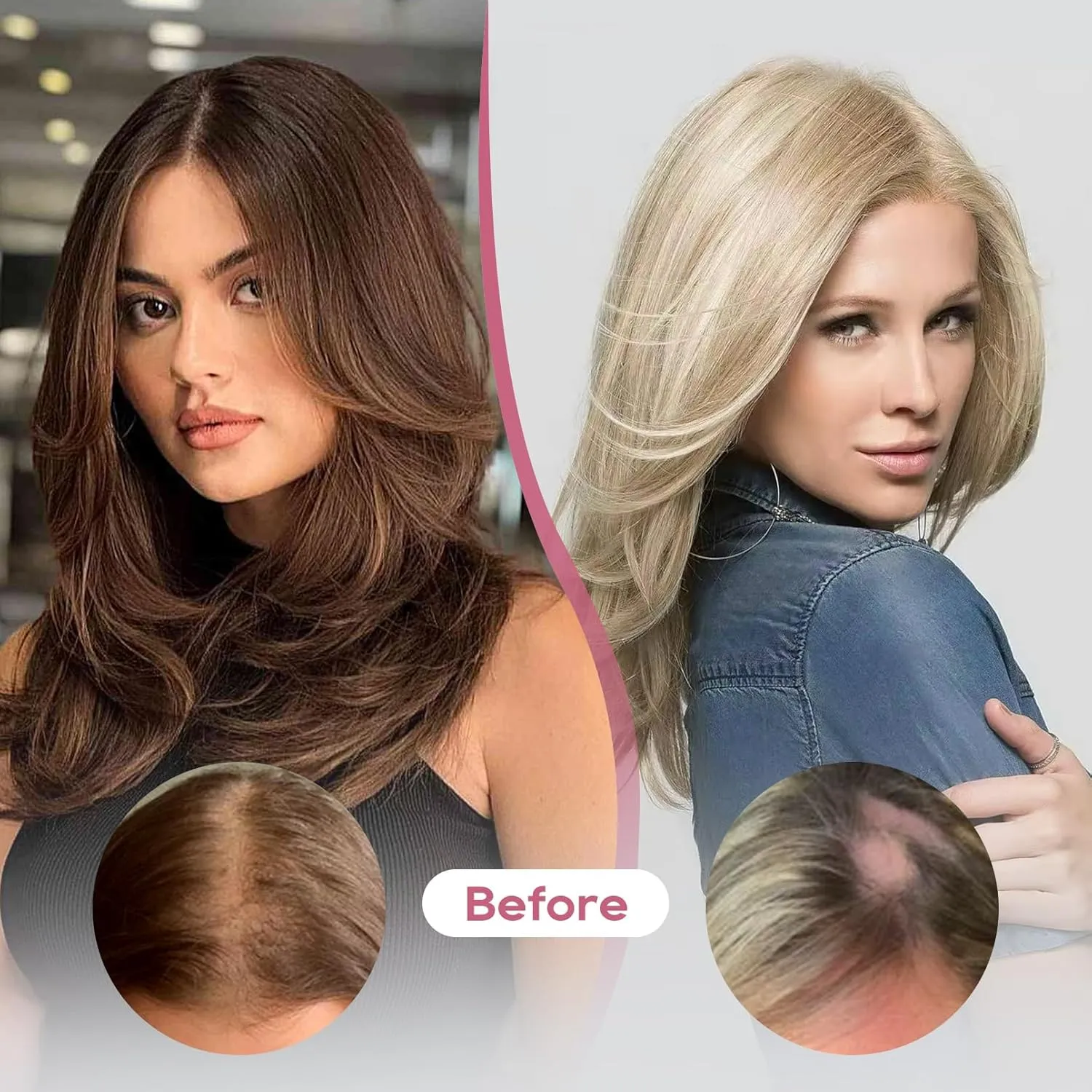 REECHO Human Hair Topper, 10 Inch Hair Toppers for Women Real Human Hair, Real Human Wiglet Adding Targeted Coverage for Thinning Hair, Chestnut Brown with Highlights